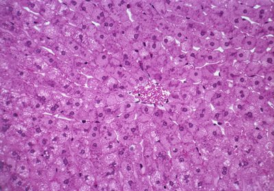 Liver Cells by Unknown